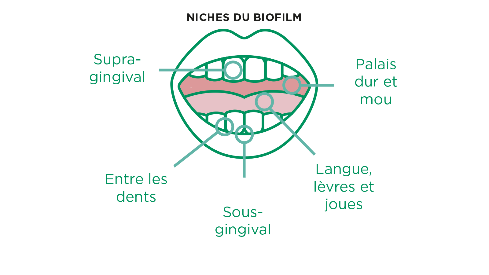 Schéma anatomique de la bouche montrant les six principales niches de biofilm buccal : supragingival, sous-gingival, entre les dents, les palais durs et mous, ainsi que la langue, les lèvres et les joues.