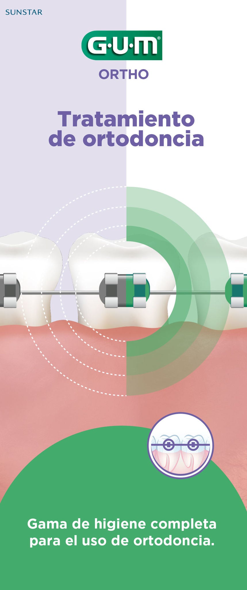 Folleto informativo para el cuidado bucal de portadores de ortodoncia