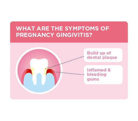 Pregnancy Gingivitis Causes And Facts: Keeping Patients Informed