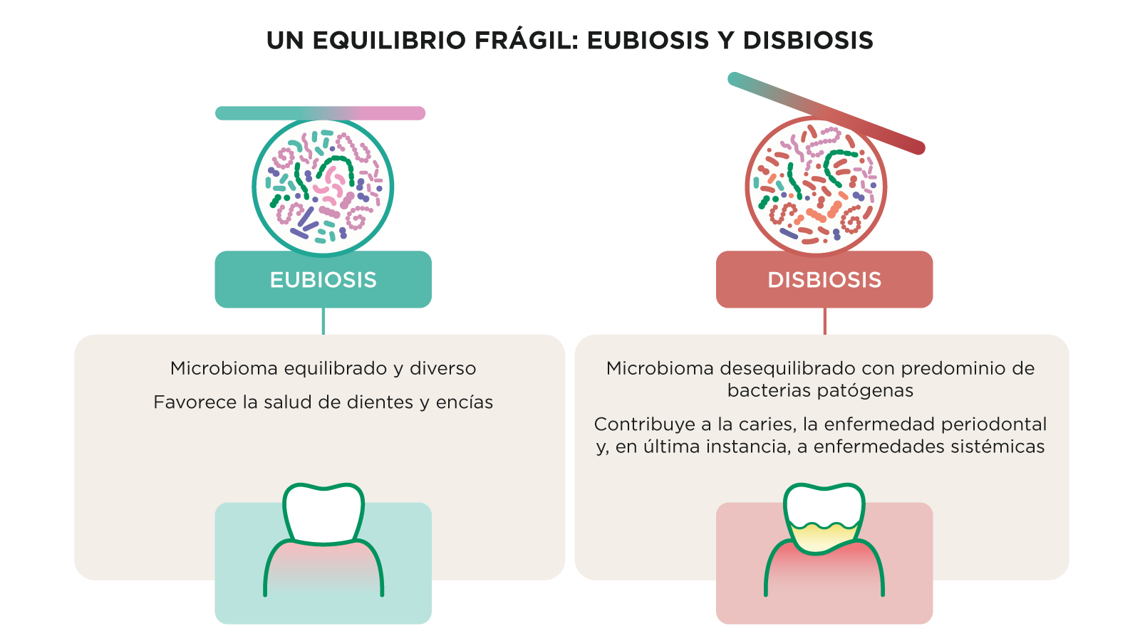 Diagrama que muestra la diferencia entre eubiosis y disbiosis en el microbioma oral, con una comunidad microbiana equilibrada por un lado y bacterias patógenas dominando por el otro