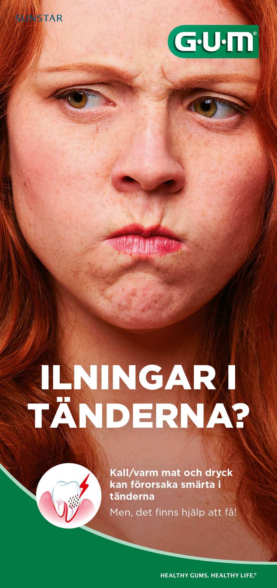 Patientfolder - Ilningar i tänderna