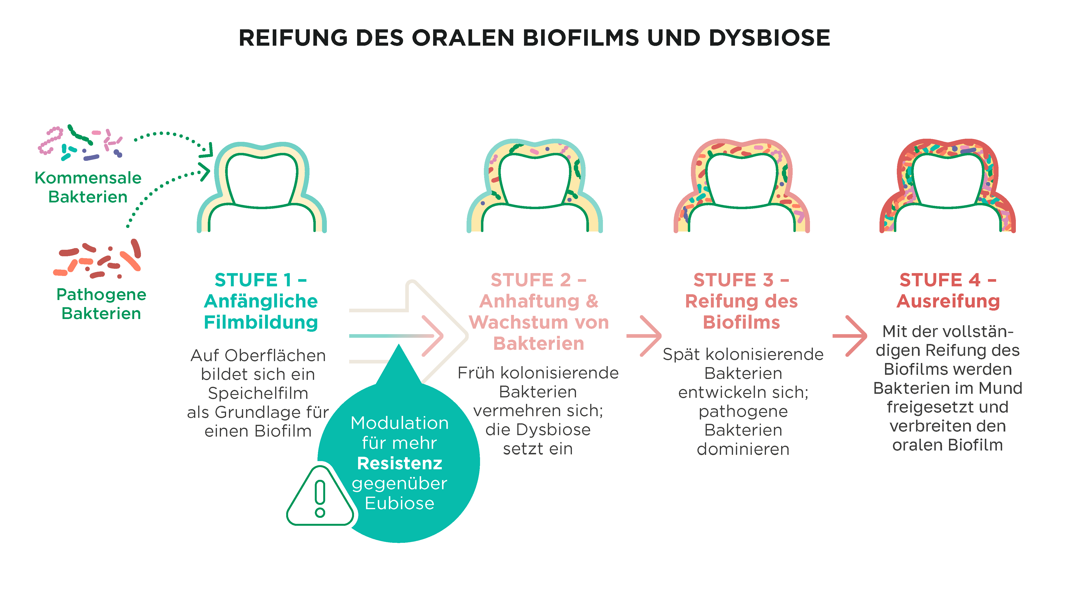 Illustration der vier Phasen der Reifung des Zahnbiofilms, von der anfänglichen Bildung der Speichelpellikel bis zur vollständigen dysbiotischen Plaquebildung