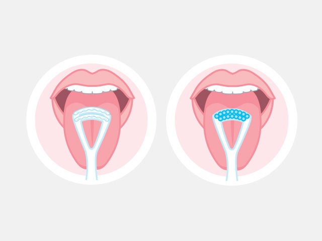 Two mouths are illustrated to show how the GUM TONGUE CLEANER brushes and scrapes the tongue