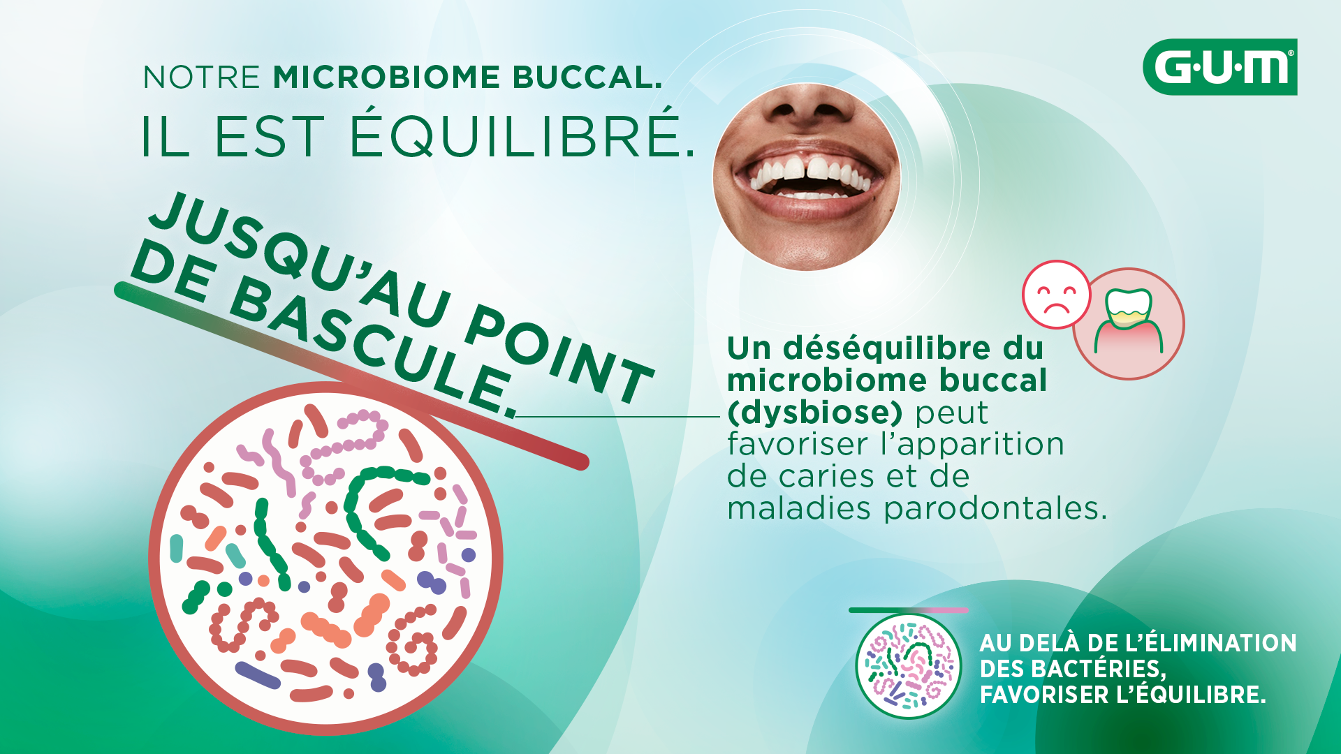 Représentation visuelle de la dysbiose buccale se développant à partir d’un déséquilibre du microbiome buccal.
