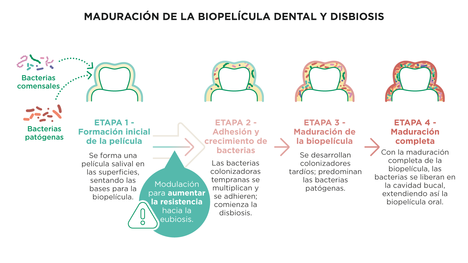 Ilustración de las cuatro etapas de la maduración de la biopelícula dental, desde la formación inicial de la película salival hasta el desarrollo completo de la placa disbiótica