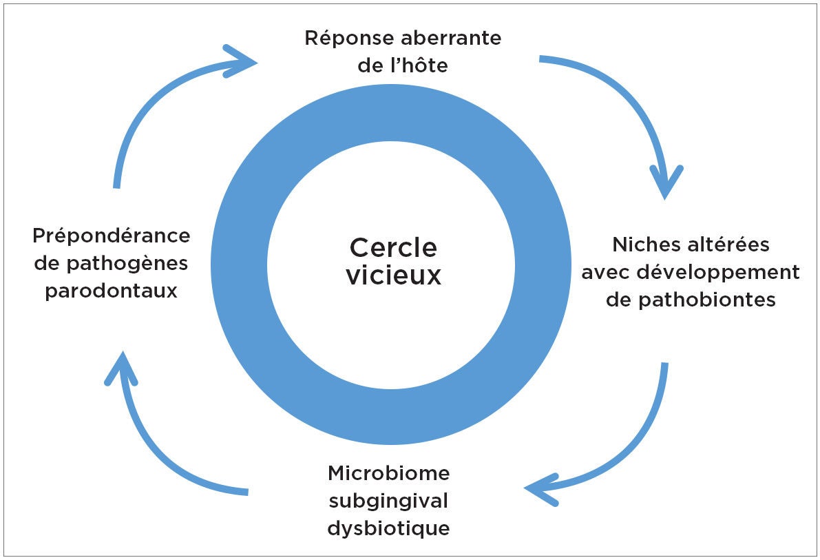 étapes-du-cercle-vicieux-dans-la-parodontite