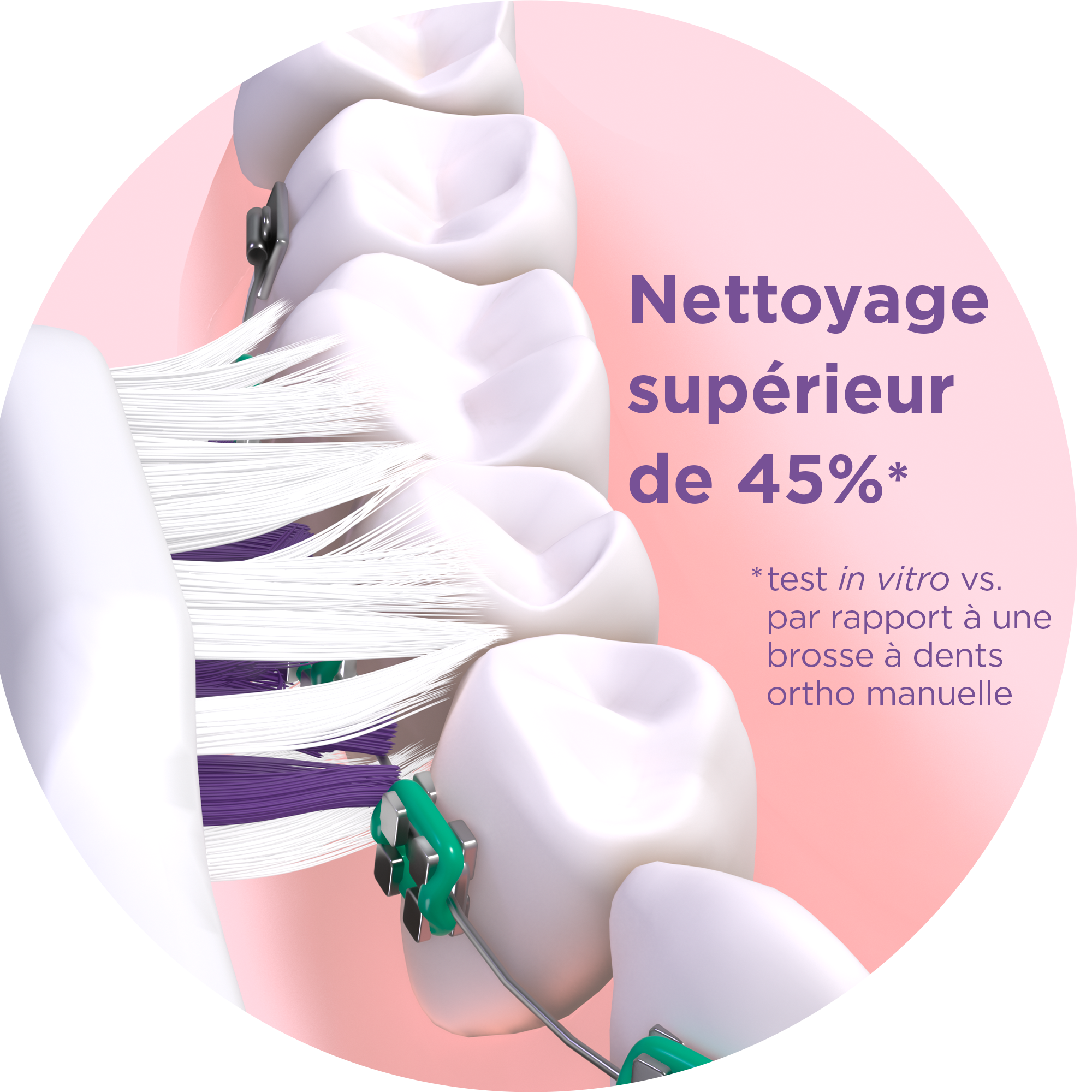GUM-SONIC-ORTHO-ProductPage-Header-IN-ACTION-FR.png