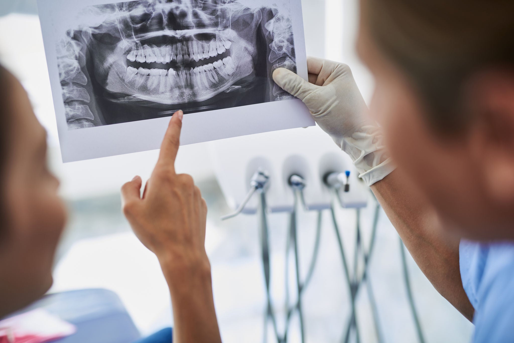 Close up of stomatologist hand holding x-ray of teeth while lady pointing at it. Dental instruments on blurred background