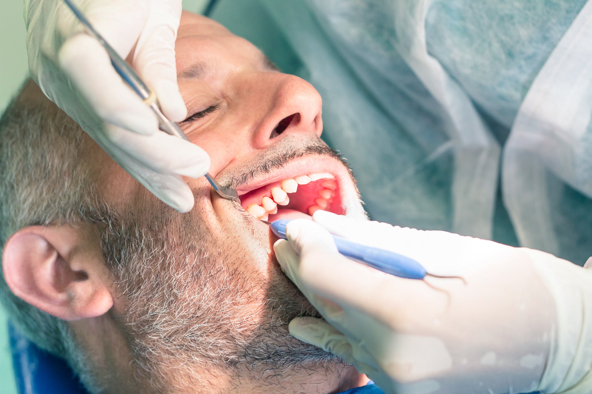Collaboration avec le patient pour un suivi parodontal sur le long terme