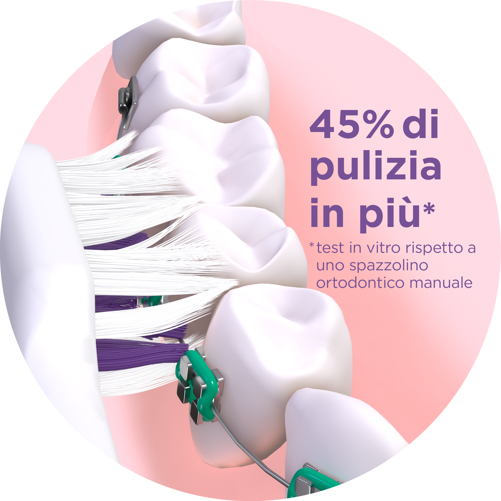 GUM-SONIC-ORTHO-Toothbrush-focus-on-head-brushing-teeth-with-braces1-IT.png