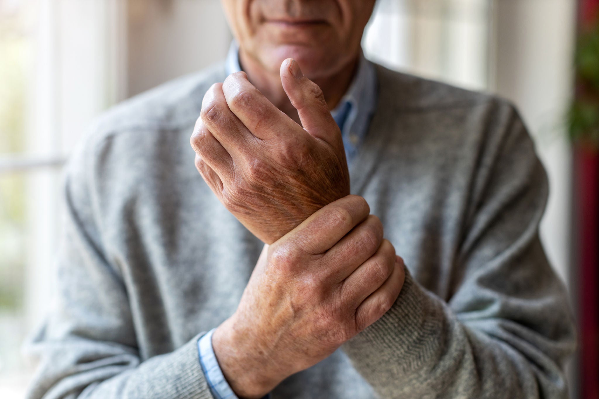 Salute orale e artrite reumatoide: fatti e risultati chiave