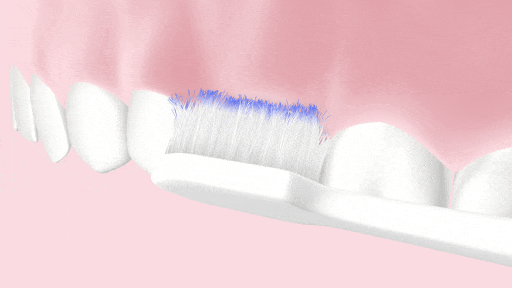 GUM Sonic Daily with the single tapered bristles clean the areas where the plaque is accumulated